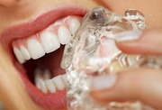 Dental Jewelry